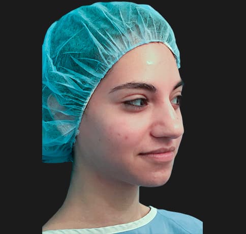 Case 34106 , Performed By Dr. Tehrani – angle 5 Before
