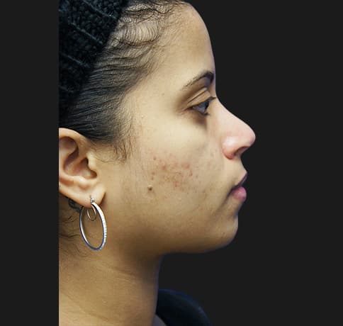 Case 21237 , Performed By Dr. Tehrani – angle 5 After