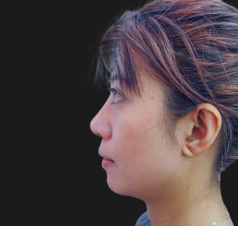 Case 8805 , Performed By Dr. Tehrani – After