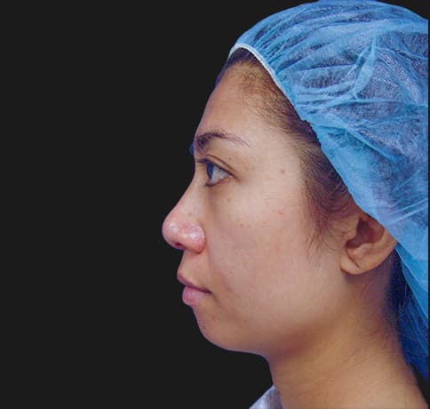 Case 8805 , Performed By Dr. Tehrani – Before