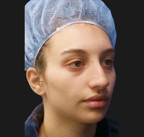 Case 38987 , Performed By Dr. Tehrani – Before