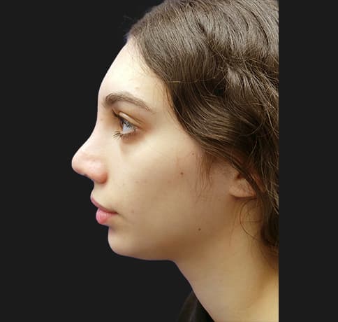Case 38987 , Performed By Dr. Tehrani – After