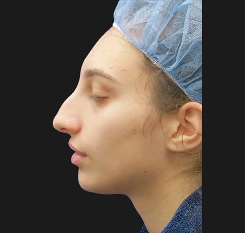 Case 38987 , Performed By Dr. Tehrani – Before