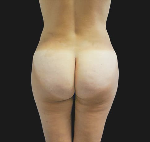 Case 22943, Performed By Dr. Tehrani – After