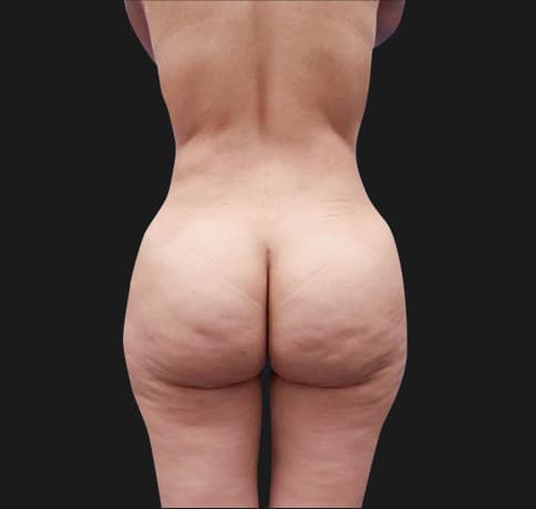 Case 20226, Performed By Dr. Tehrani – After