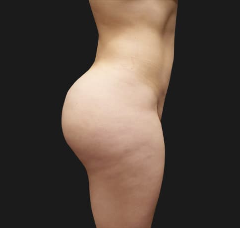 Case 342024, Performed By Dr. Tehrani – After