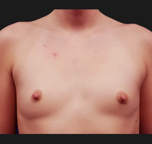Case 20958, Performed By Dr. Tehrani – Before