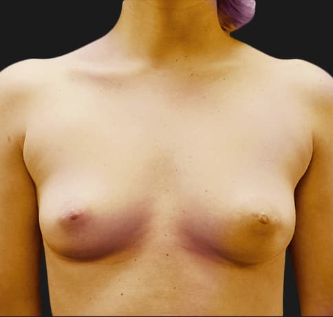 Case 19360, Performed By Dr. Tehrani – Before