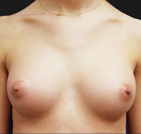 Case 29273, Performed By Dr. Tehrani – After
