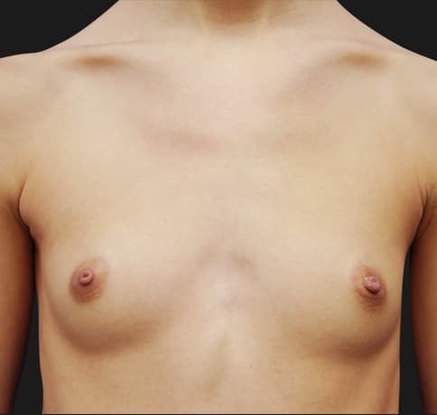 Case 29273, Performed By Dr. Tehrani – Before