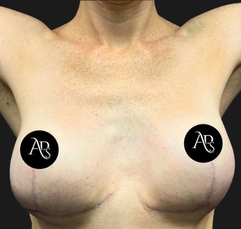 Case 54931, Performed By Dr. Tehrani – After