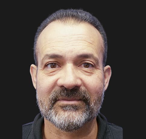 Case 40063, Performed By Dr. Tehrani – After
