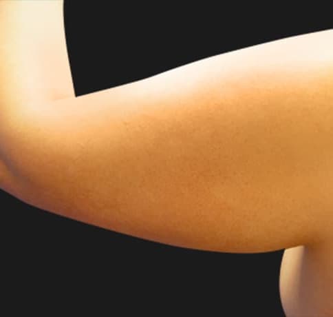 Case 6756, Performed By Dr. Tehrani – Before