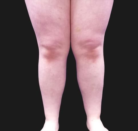 Case 42619, Performed By Dr. Tehrani – After