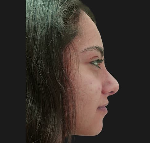 Case 34106 , Performed By Dr. Tehrani – After