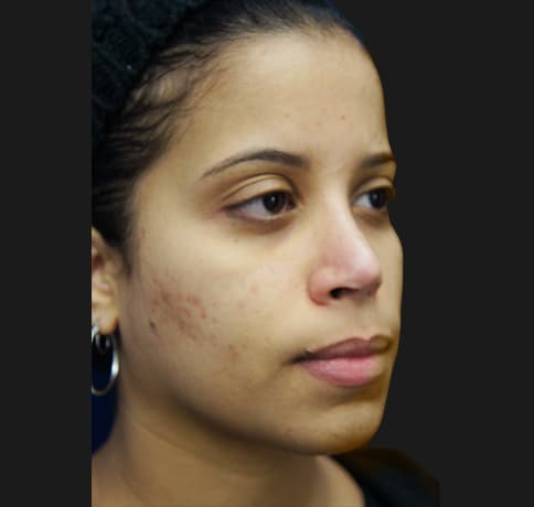 Case 21237 , Performed By Dr. Tehrani – After