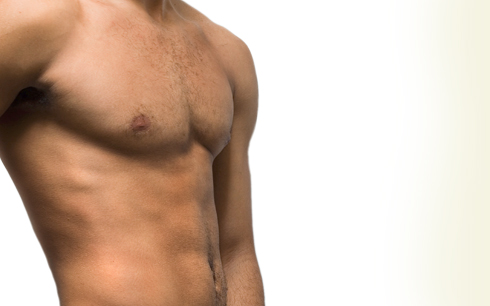 nyc male plastic surgery