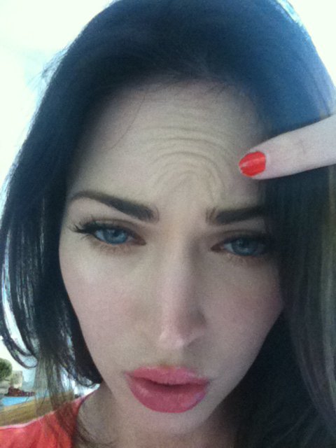 Megan Fox Botox