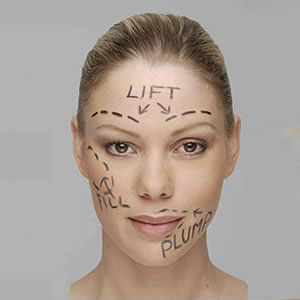 Plastic Surgery trends for teens