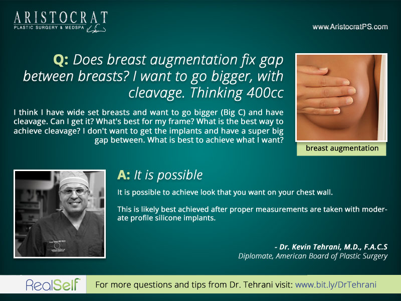 Q&A: Will Breast Augmentation Fix The Gap Between Breasts? – Aristocrat  Plastic Surgery
