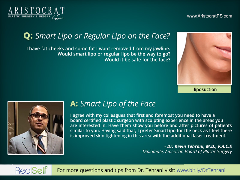 Q&A: What's The Best Solution, SmartLipo Or Regular Lipo On The Face? –  Aristocrat Plastic Surgery