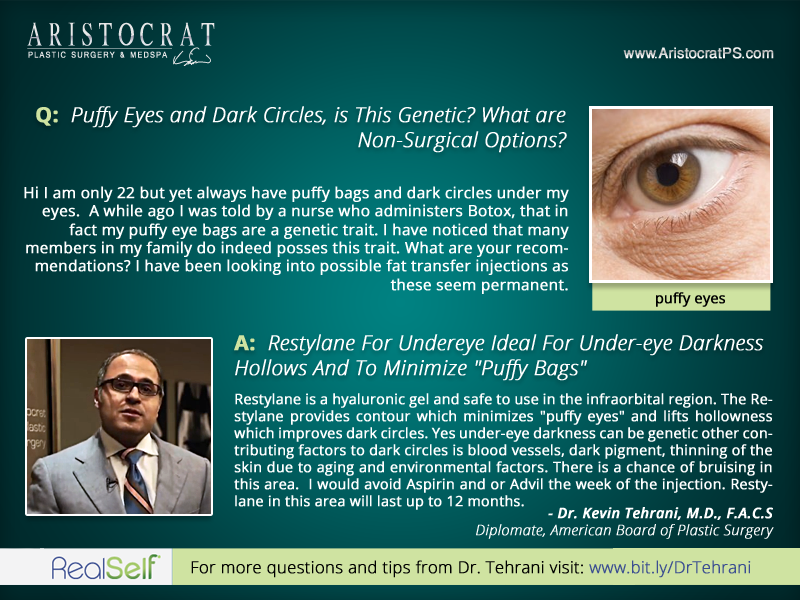 Do You Have Puffy Eyes And Dark Circles? - Costhetics