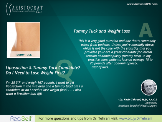 liposuction vs tummy tuck