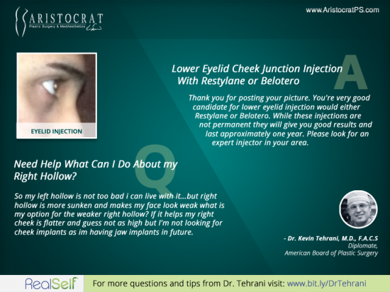 Aristocrat-plastic-surgery-patient-eyelid