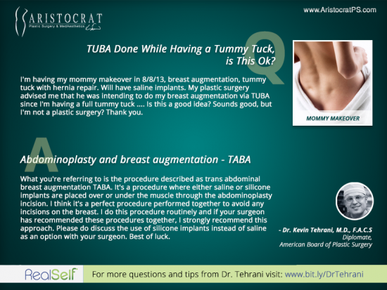 TUBA-TABA-abdominoplasty