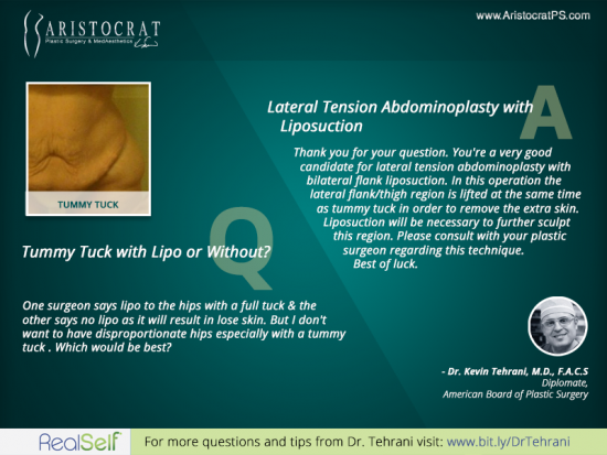 tummy-tuck-liposuction