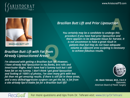 Aristocrat-plastic-surgery-brazilian-butt-lift