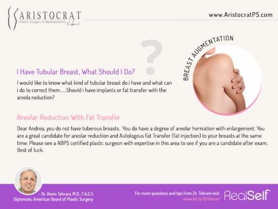 Tubular-breast-aristocrat-plastic-surgery