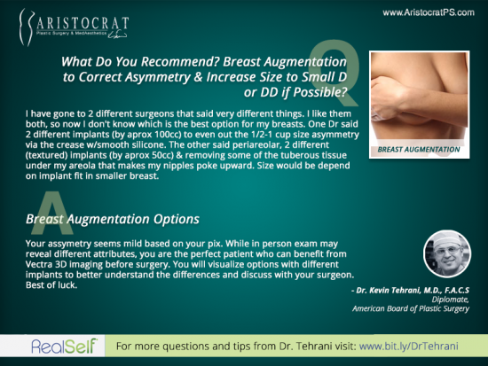 breast-augmentation-summetry