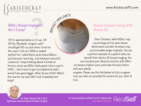 breast-implants-aristocrat-ps