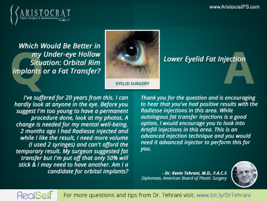 eyelid-surgery-aristocrat-q&a