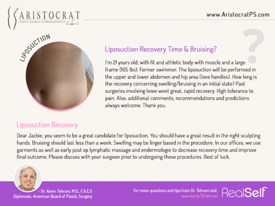 liposuction-plastic-surgery