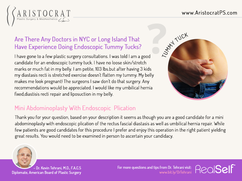 Long Island Tummy Tuck Surgeon