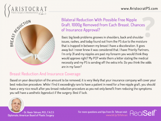 Breast-Reduction-And-Insurance-Coverage