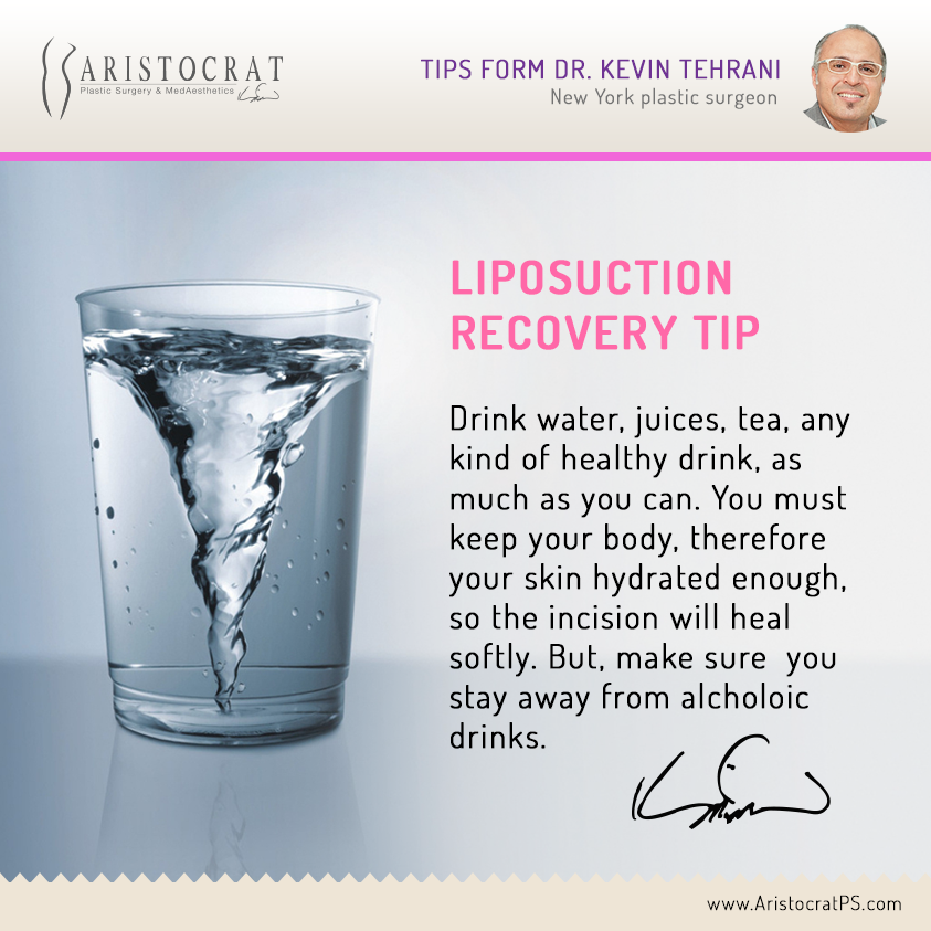 Liposuction Recovery