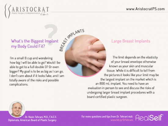 breast-implant-aristocrat-ps