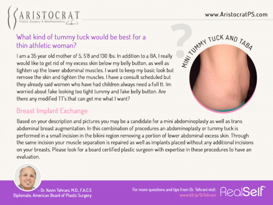 tummy-tuck-aristocrat-plastic-surgery