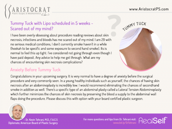 Tummy Tuck New York