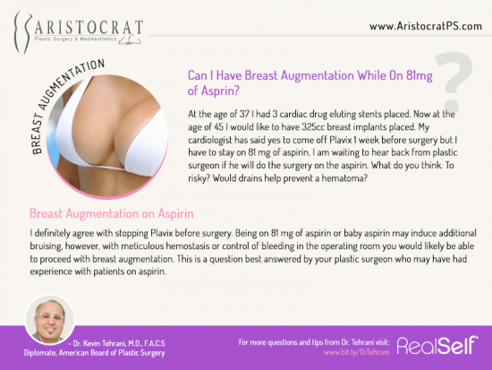 breast-augmentation-Aristocrat-PS