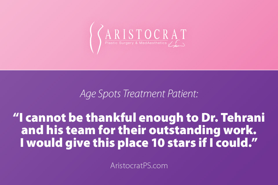 age spots treatment