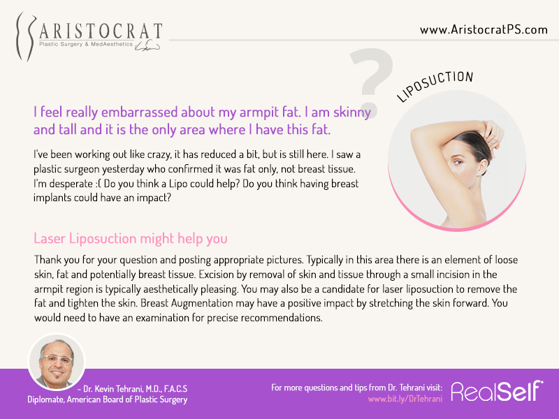 liposuction