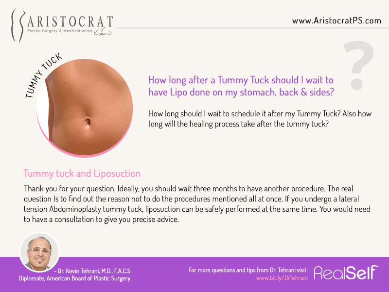 tummy tuck