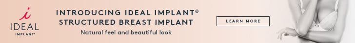 Ideal Implant Digital Ad