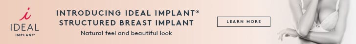 IdealImplant_DigitalAd Ideal Implant Digital Ad