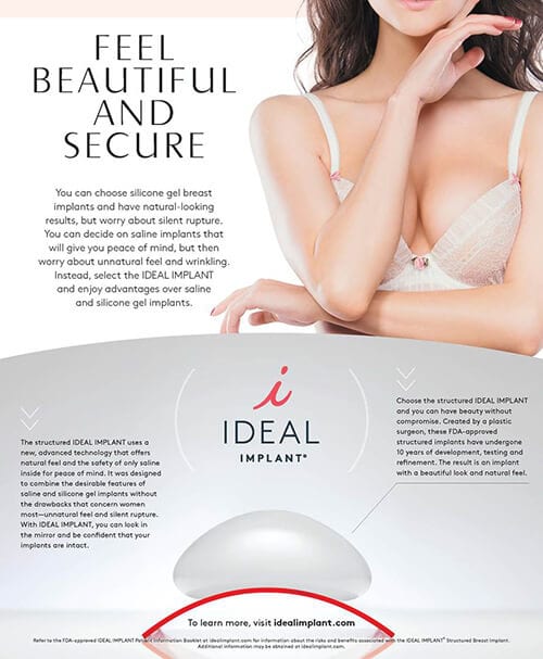 idealimplant ideal implant information