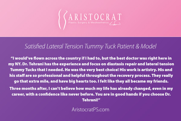 lateral tension tummy tuck